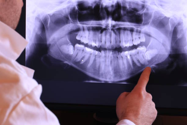 Best Emergency Root Canal Treatment in Lewisburg, WV