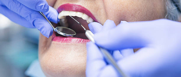 Best Emergency Tooth Extraction in Lewisburg, WV