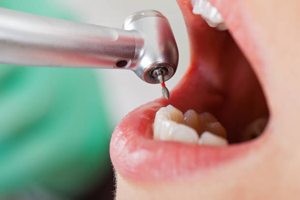 Best Pediatric Emergency Dentist in Lewisburg, WV